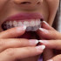 Atpalaiduojantis dantų įtvaras - dantų pagalvėlės 22113